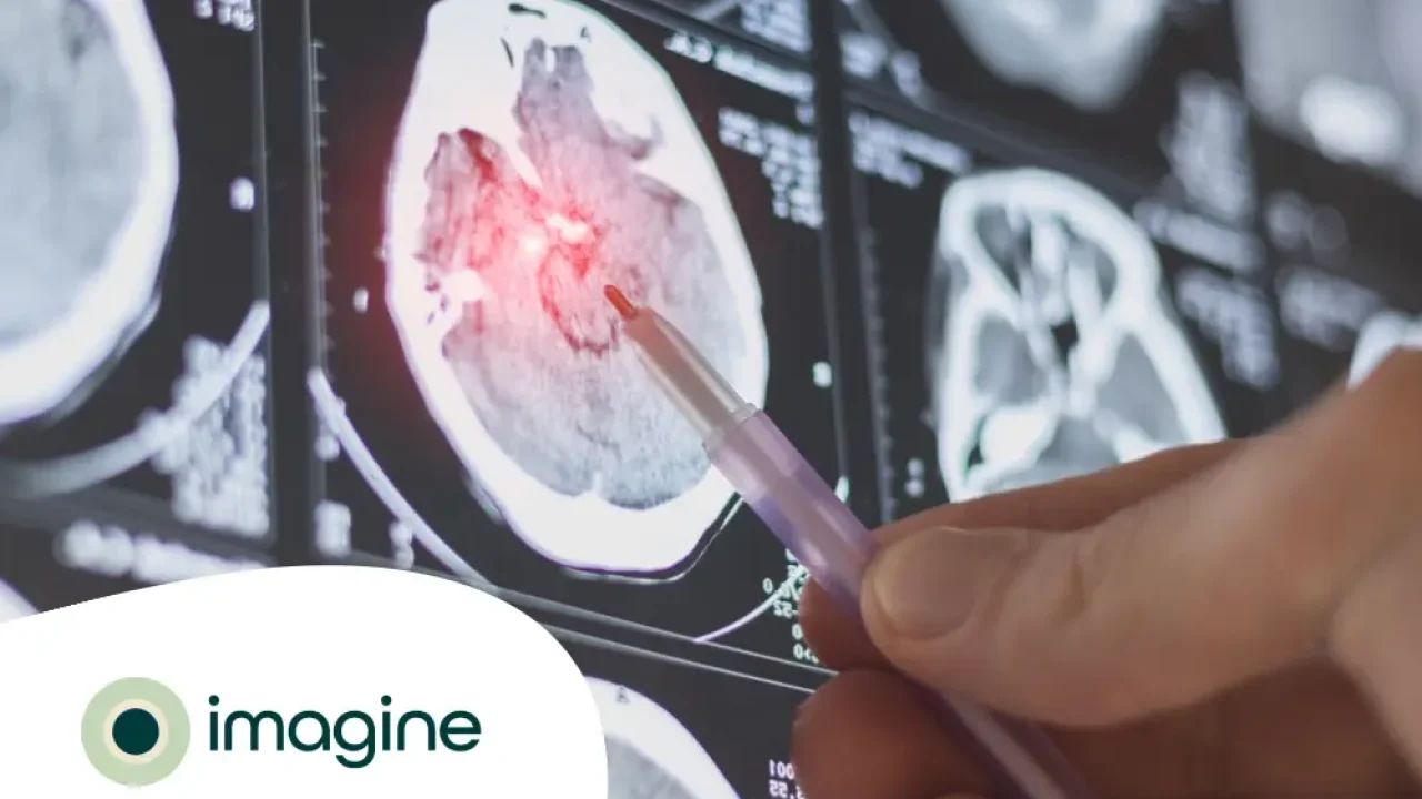 tomografia-tem-muita-radiacao-e-perigosa